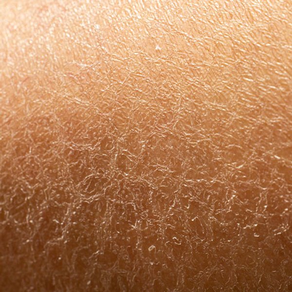 Close-up of dry skin texture